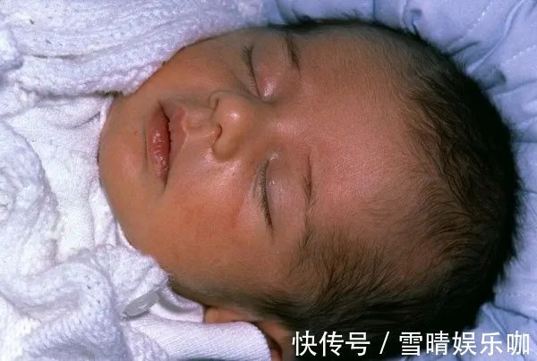 怀孕|不想宝宝出生后被黄疸“找上门”,孕期孕妈坚持“三不做”很关键