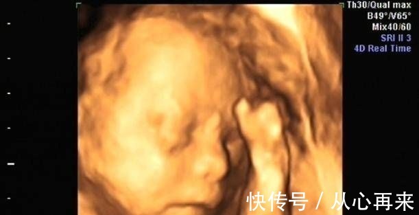 小茹|为什么有些医院做四维彩超不让家属陪同这些原因,大家有权知道