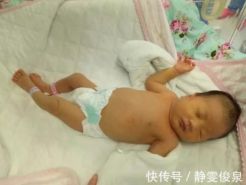 消退|怕宝宝出生有黄疸?孕期保持“3个不做”,建议准爸准吗收好