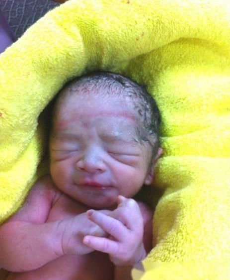 罗医生|经过了一夜的待产,终于要跟宝贝见面了,我的剖腹产记录