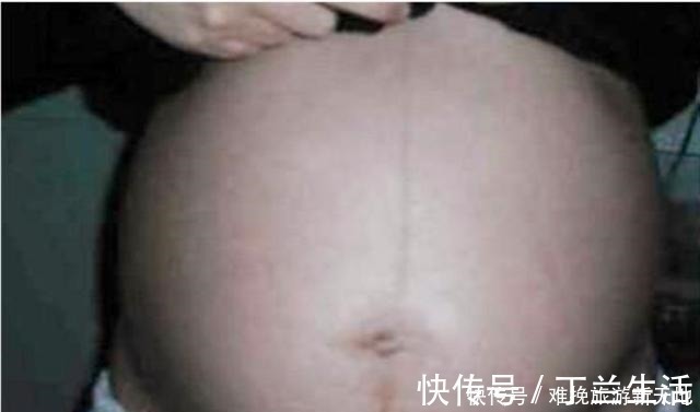 孕期|孕期这些部位黑到“怀疑人生”，孕妈别担心，这是娃发育好的表现