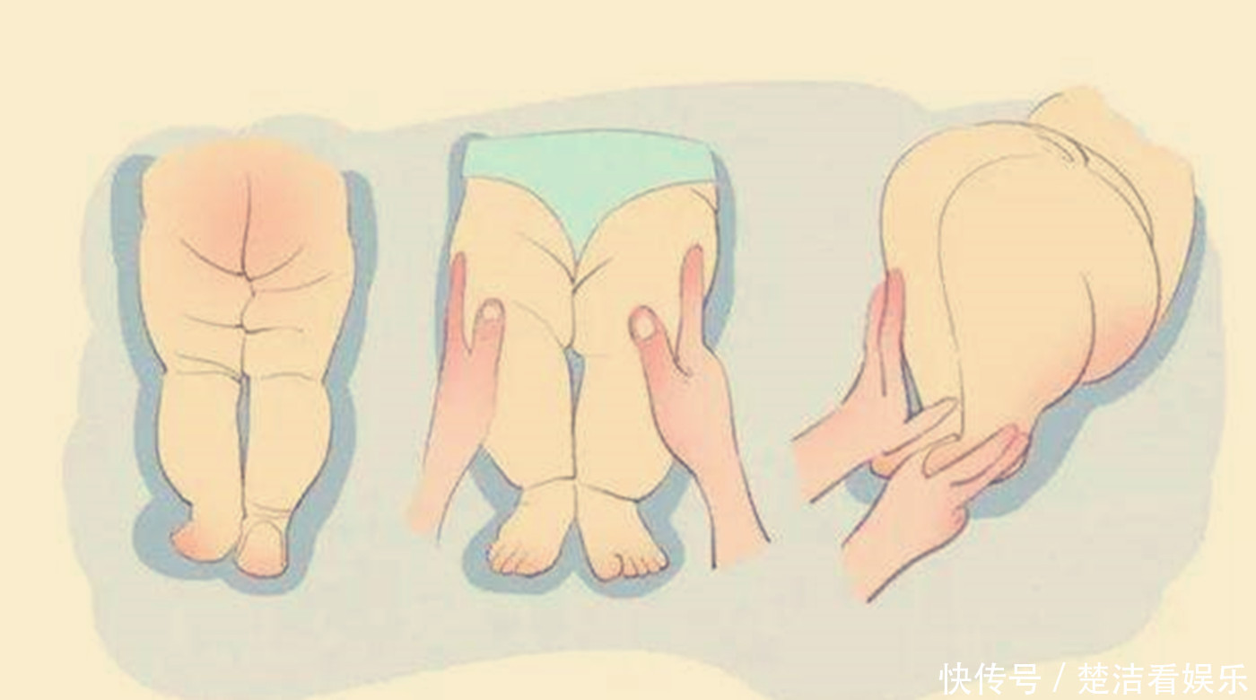 宝宝的臀纹腿纹不对称?一岁前要当心些,排除原因才安心