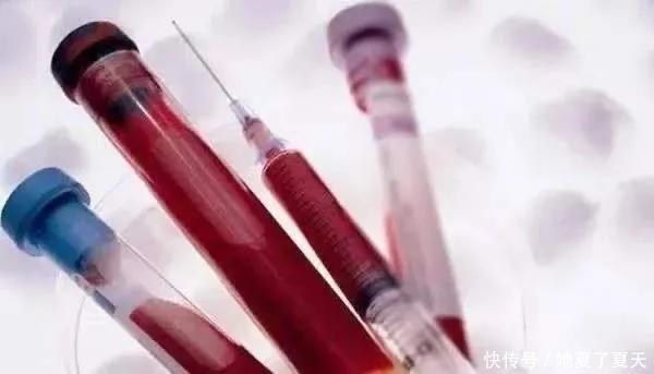 活多久|感染上艾滋病,多久才能发觉感染艾滋后,我们还能活多久