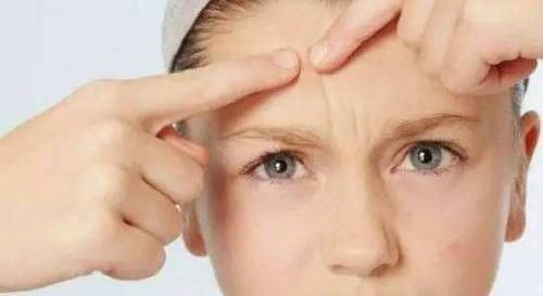 辛辣食物|经常冒痘的人,都有以下3个特征,看看你中了几个