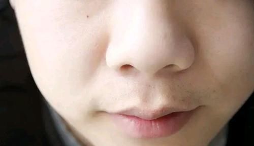 鼻子两侧的白色分泌物是什么东西?为何越挤越多?一起来了解一下