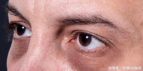 病变|肝硬化害怕“1种水”,不是枸杞水,平时敞开喝,肝脏干净柔软