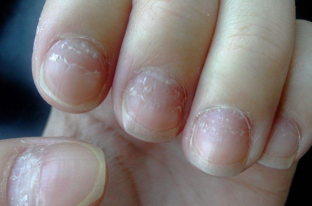 医生|消化科医生养胃很简单,3种“零食”,你若爱吃,胃自然好起来