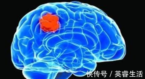 第三题|最新老年痴呆测试如果你5道题全错，那请自觉打车去医院吧