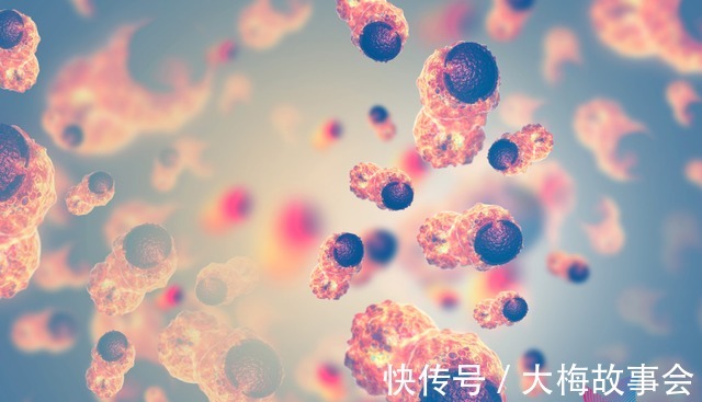 结直肠癌|为啥癌症一发现就是中晚期8个不起眼的求救信号！