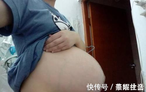悬浮肚|90后孕妈“悬浮肚”火了,网友啧啧称奇,产科医生叹息:这很危险