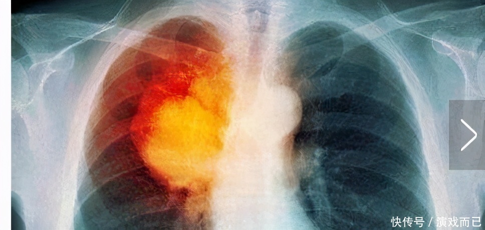 每天一小杯,可杀死体内癌细胞可以排出身体10年的毒素