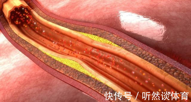 空腹|空腹血糖与餐后血糖,哪个更重要?弄不明白,血糖基本等于白测