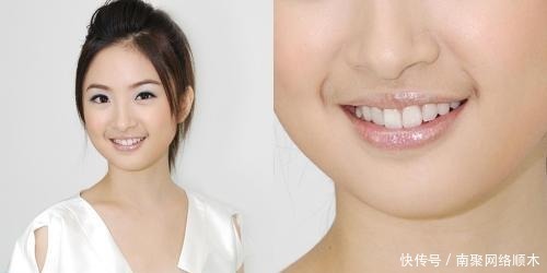 为什么有些女生的嘴唇上会长“胡子”?教你两招,轻松去除掉