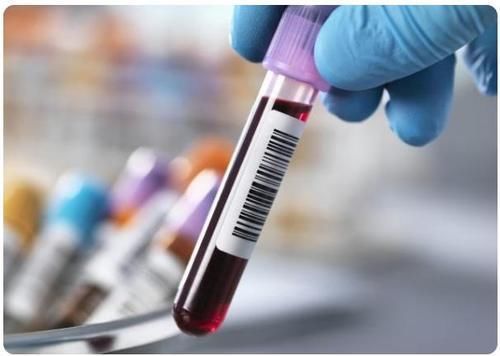 肥胖|甘油三酯偏高就患了高血脂?提醒:未超过这个数,或无需担心