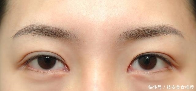 药店有二种“医用眼霜”,对付皱纹眼袋小菜一碟,遗憾是知道的人太少