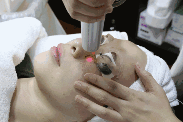 反黑 做完光子嫩肤之后反黑了怎么办呐?什么是反黑?术后该如何护理?