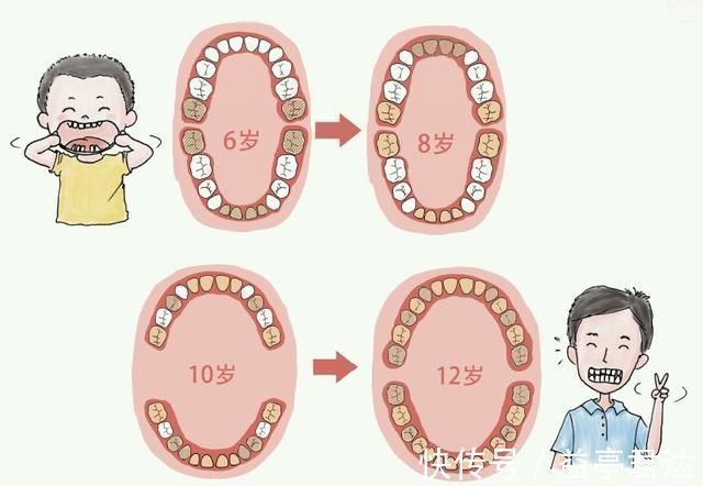 双排牙|6-12岁孩子换牙期,父母困惑可不少:双排牙、锯齿状、缝隙大等