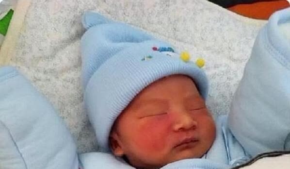 宝宝|宝宝的胎记怎么来的?产科医生:孕期这2种行为易长胎记,要避开