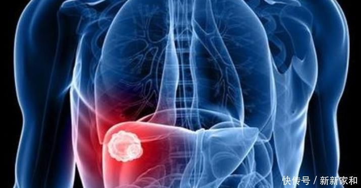 泡枸杞时加此物,肝毒没了,远离肝硬化、肝癌,肝会跪谢你的做法