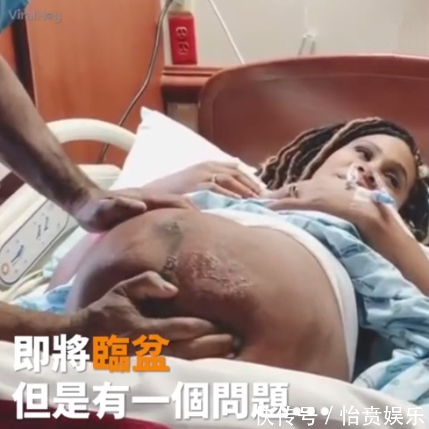 枕前位|医生徒手帮孕妈转胎位,当妈真的不容易,网友这肚皮都薄成纸了