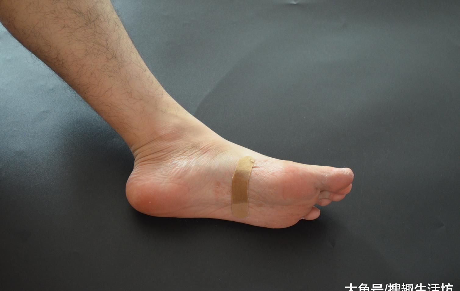 风油精滴在创可贴上, 放在家里这样用, 解决了家家户户困扰的难题