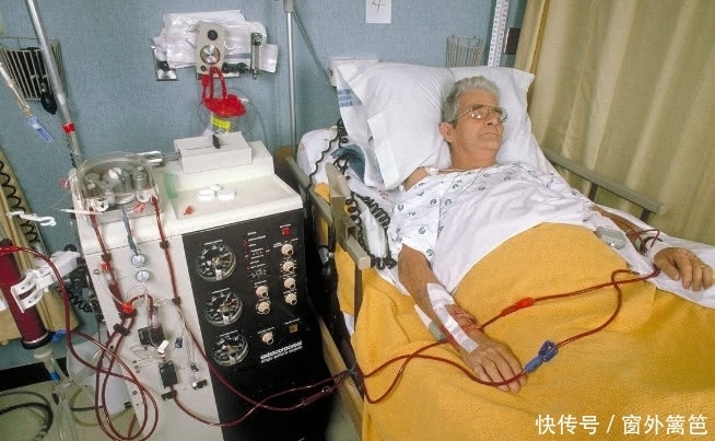祸首|全国“尿毒症”新增百万,3种食物是“祸首”贪吃加速“肾衰竭”