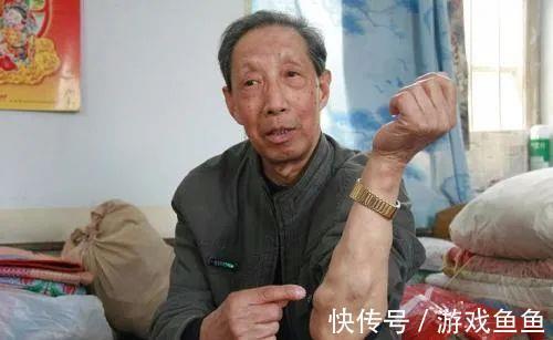 浊气|三伏化淤黄金期!灸4穴,调和气血,打通全身瘀血,预防各种结节