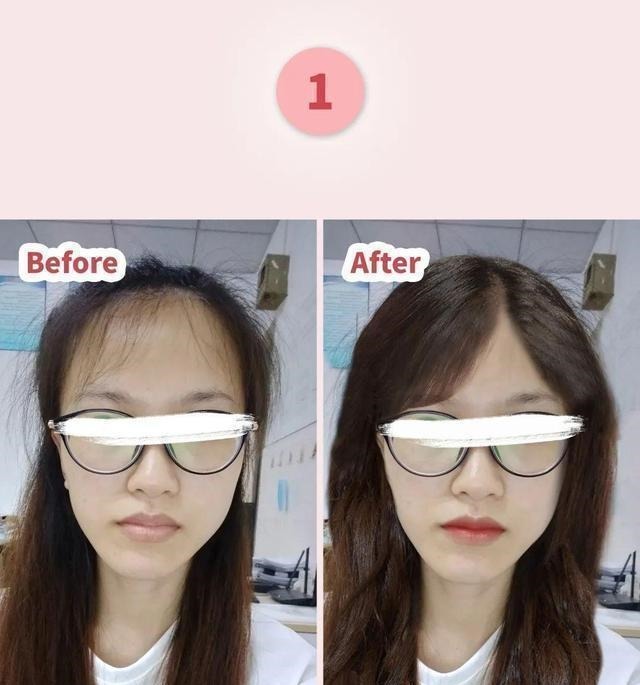 赵露思 别再留显脸大的发型了!这2款,照着剪美炸了丨粉丝发型改造