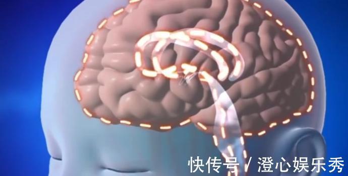 治疗|3岁女童头重达20斤,手术刚要进行,家人却放弃治疗准备寿衣