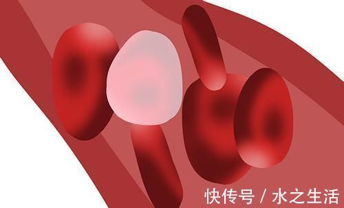 葡萄糖|甘油三酯高的人,每天走路5公里,会怎样甘油三酯能降下来吗