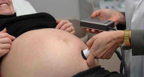 产检|孕妈十月怀胎诞下的宝宝，诊断为先天性心脏病，只因孕期不听劝
