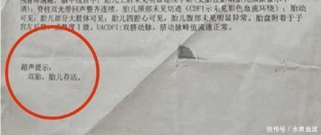 双胞胎|孕检怀了双胞胎,医生却只接生了一个,还有一个去哪了