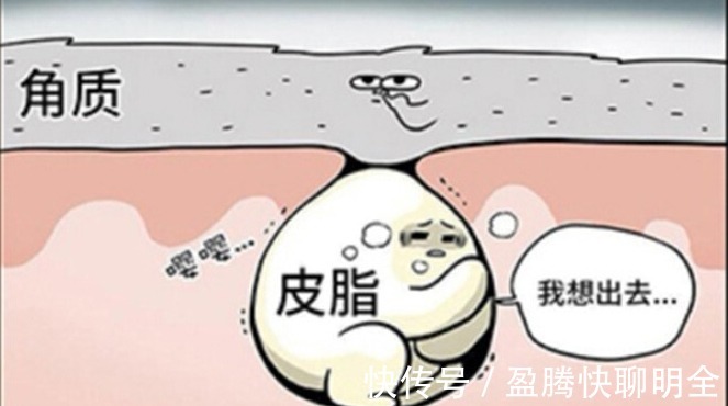 饮食习惯|男士护肤:皮肤长痘应该怎么护肤?