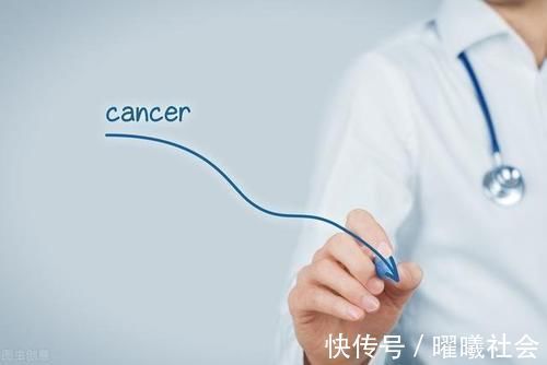 家属|癌症早期能活多长时间?肿瘤科医生实话实说