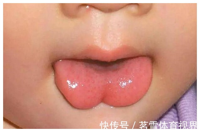 睡眠不好|苹果水能缓解小儿积食?医生建议:要想脾胃好,这2物要少吃