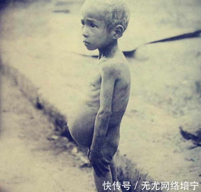 1936年大饥荒, 10张差点销毁的老照片, 百姓树皮为食