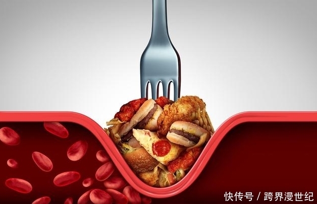 心血管疾病|不想血管越来越堵,教你4个方法,让血管垃圾自动消失!