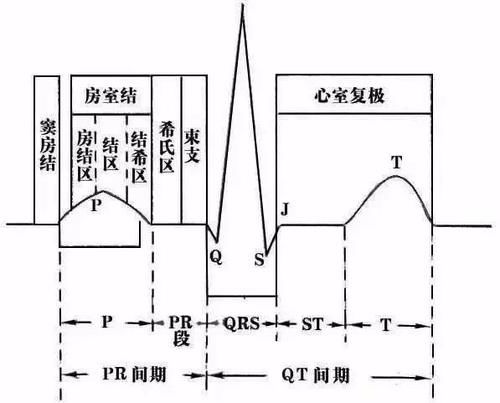 护士这样学心电图，不用死记硬背