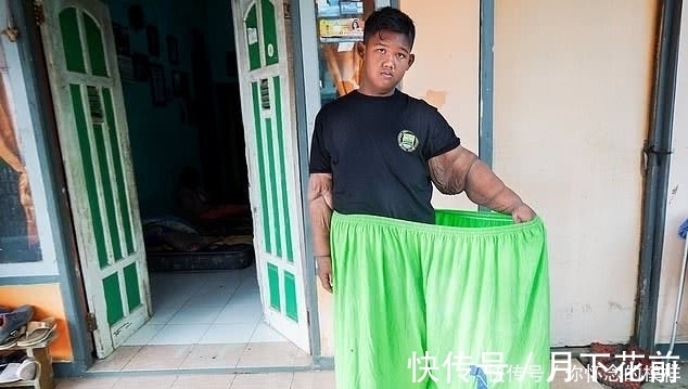 小孩|近400斤的“世界最胖小孩”减肥成功,如今他这样了!