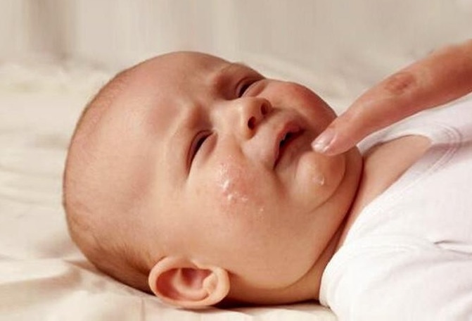 豌豆|新生儿宝贝长了好多湿疹,什么原因,2招教你快速搞定