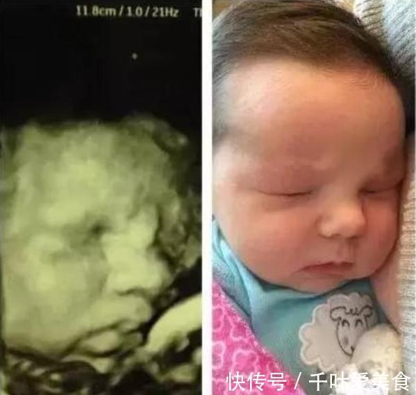 准爸爸|准妈妈在医院门外大哭，只因宝宝四维彩超太丑，网友：亲妈都嫌弃