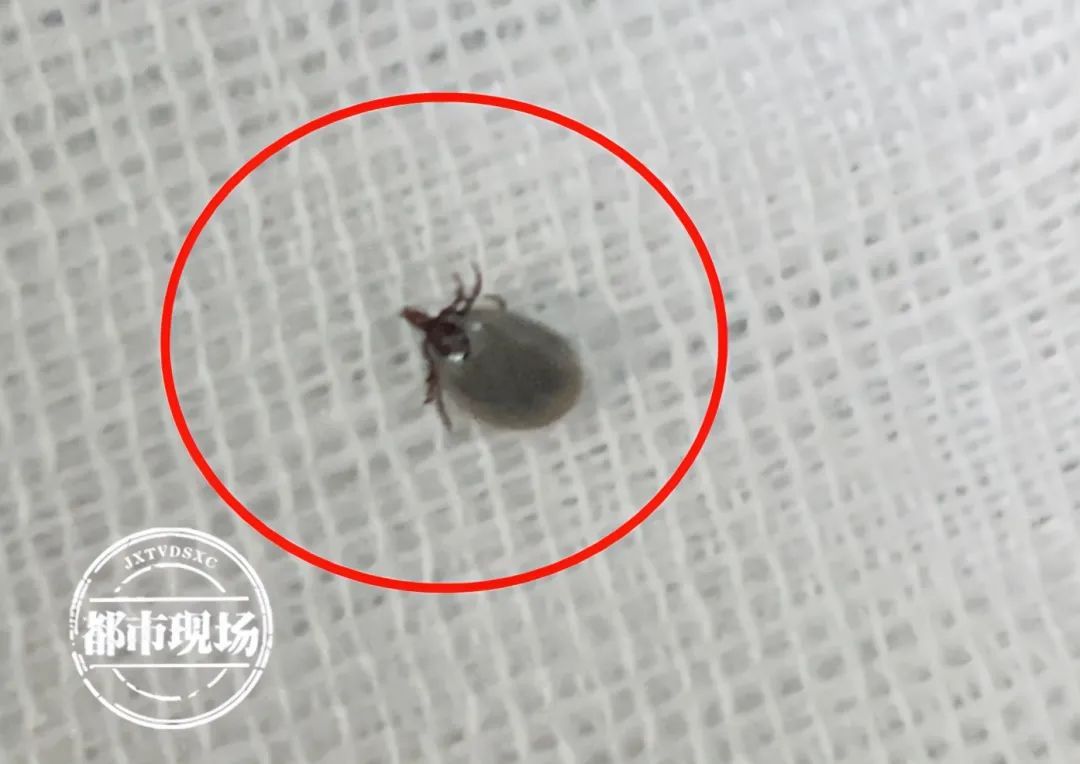 南昌|南昌一宝宝出生才4天，就被小虫咬了