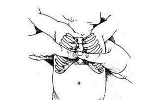 正压|宝宝出生后全身青紫,急救只用4分钟!这个方法得学!