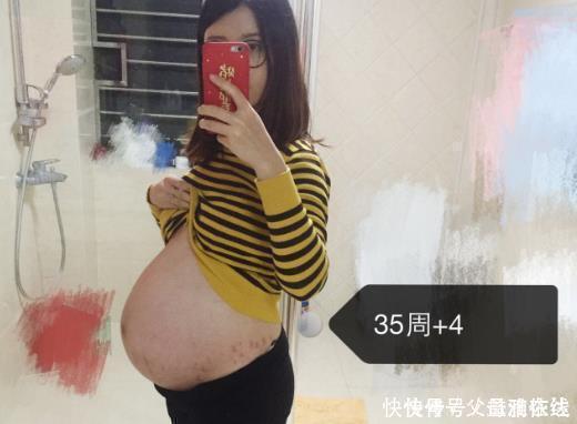 性别|看肚子你真的准吗?这些传言坑了多少孕妈?别再粗略