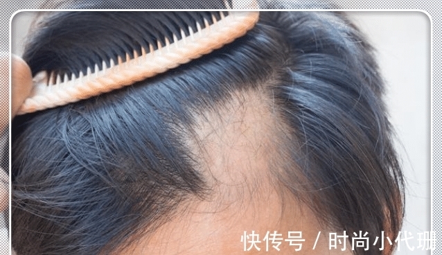 矿物油|这3种“洗发水”已被拉入黑名单,家家户户却爱用,难怪头发“大把掉”!