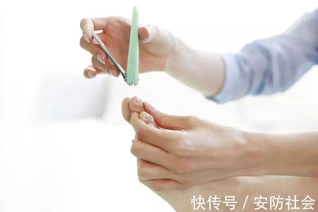 指甲缝|指甲剪不对带来大麻烦,这才是剪指甲的正确方法!