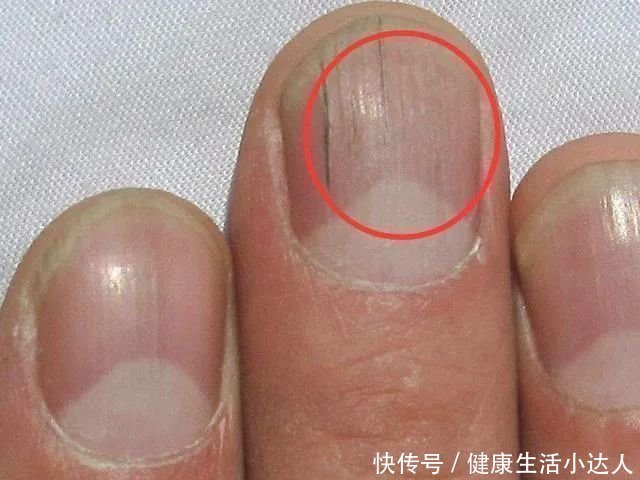 不吃早餐|晨起有4个坏习惯,毁肝没商量,身体4处有异常,最好去检查一下