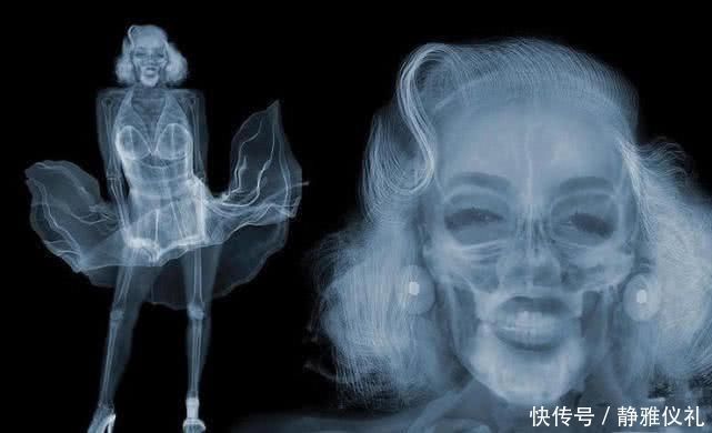 摄影 X光的世界到底长什么样杰克逊太空舞步,接吻让人哭笑不得