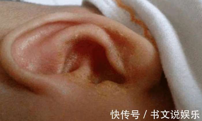 检查|妈妈发现一岁的孩子总是喜欢摸头,去医院检查后,让她庆幸不已