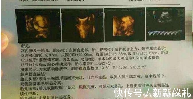 胎心率|准妈若怀有小阿哥,做B超时会有哪些数据?不妨验证一下吧